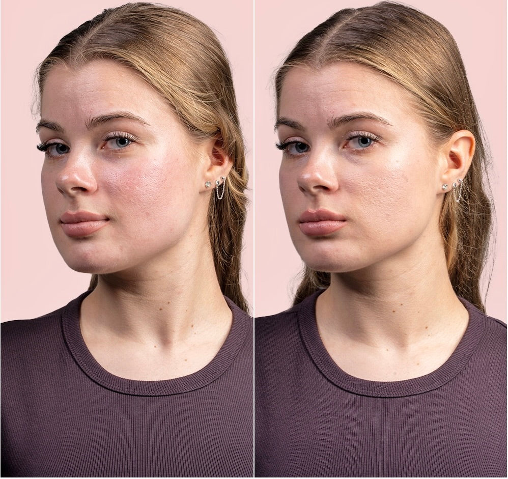 Custom made Foundation