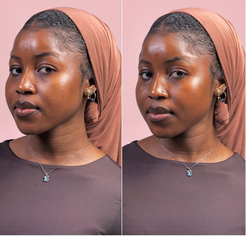 Custom made Foundation